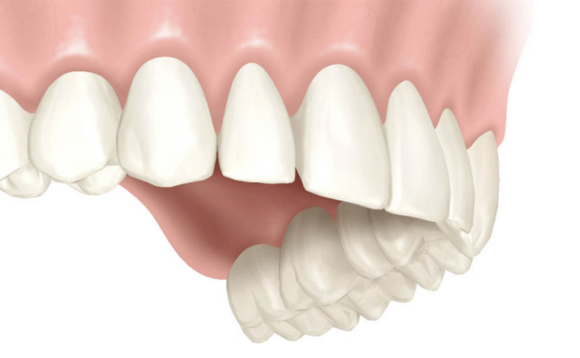 PERIODONCIA