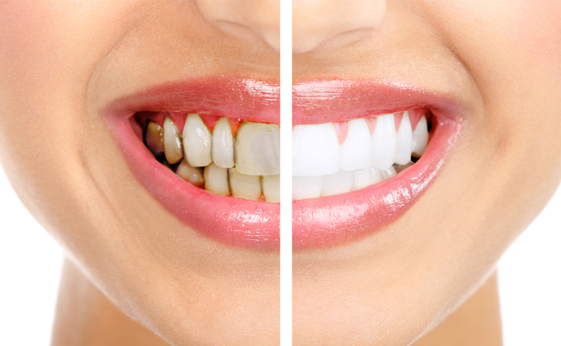 REHABILITACIÓN ORAL